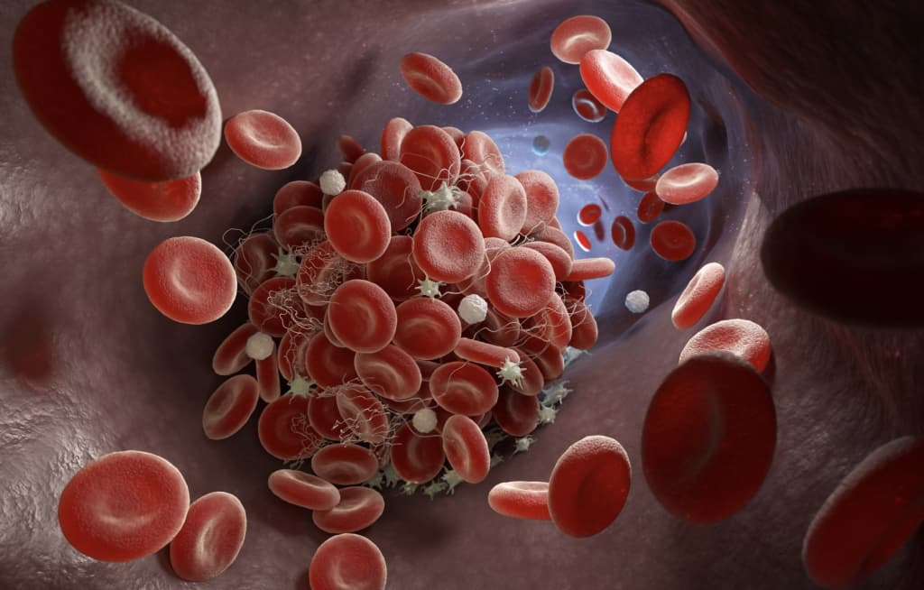 Jaziramada qon quyuqlashishi — insult va infarkt xavfini oshiradi