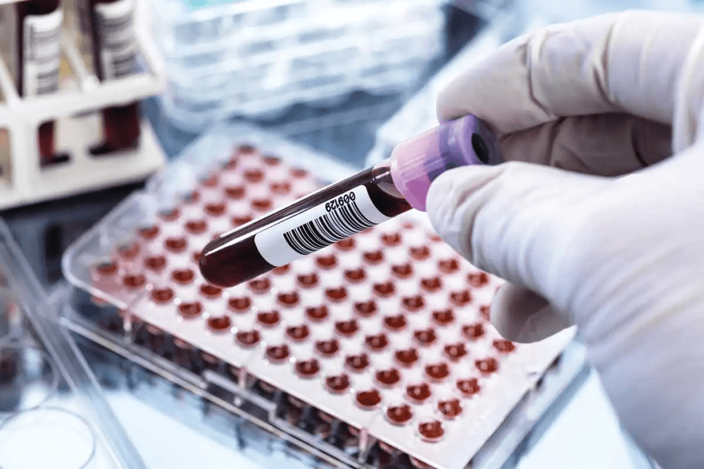 Olimlar qon tahlili orqali depressiyani aniqlash usulini ishlab chiqdilar