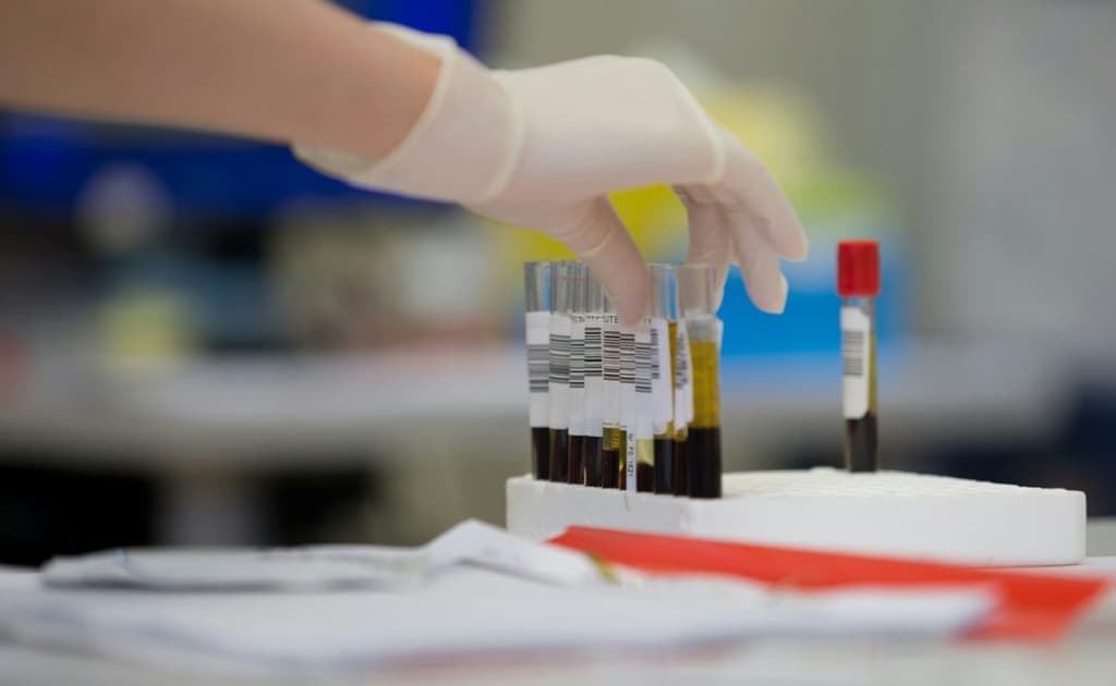 Yaponiya olimlari barcha qon guruhlari uchun mos sun’iy qon yaratdi