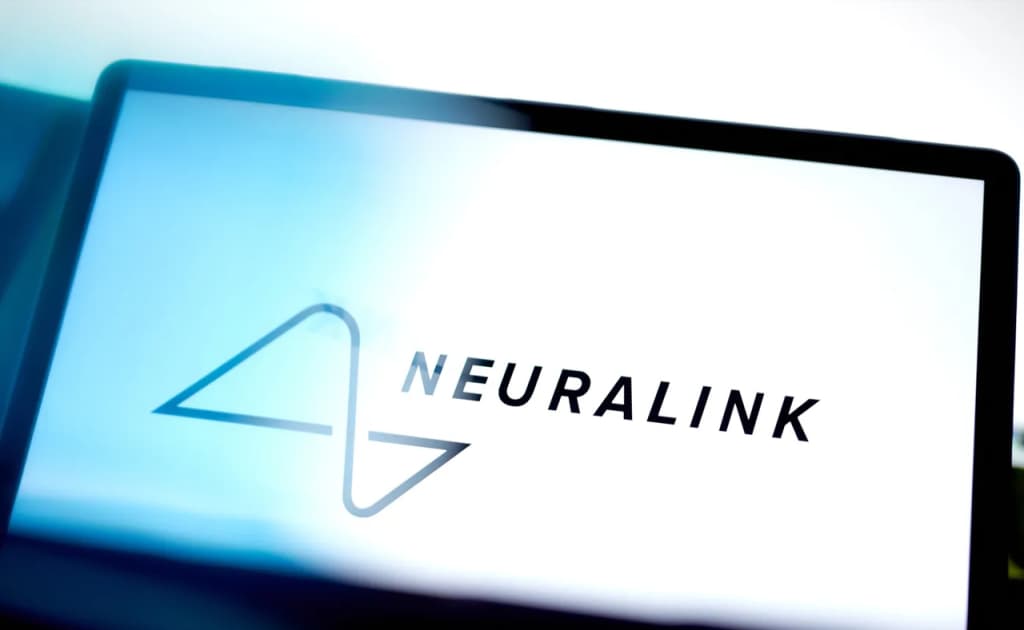 Neuralink har yili 20 ming bemorga neyrochip o‘rnatmoqchi