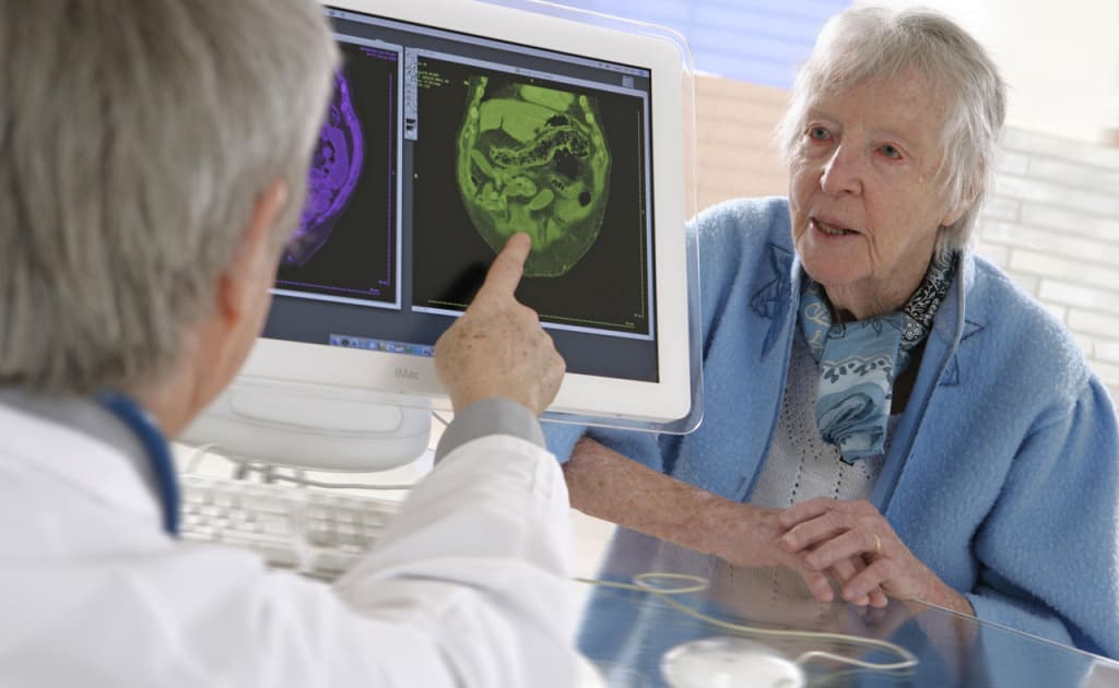 Garvard olimlari Alsgeymer kasalligiga davo topdi