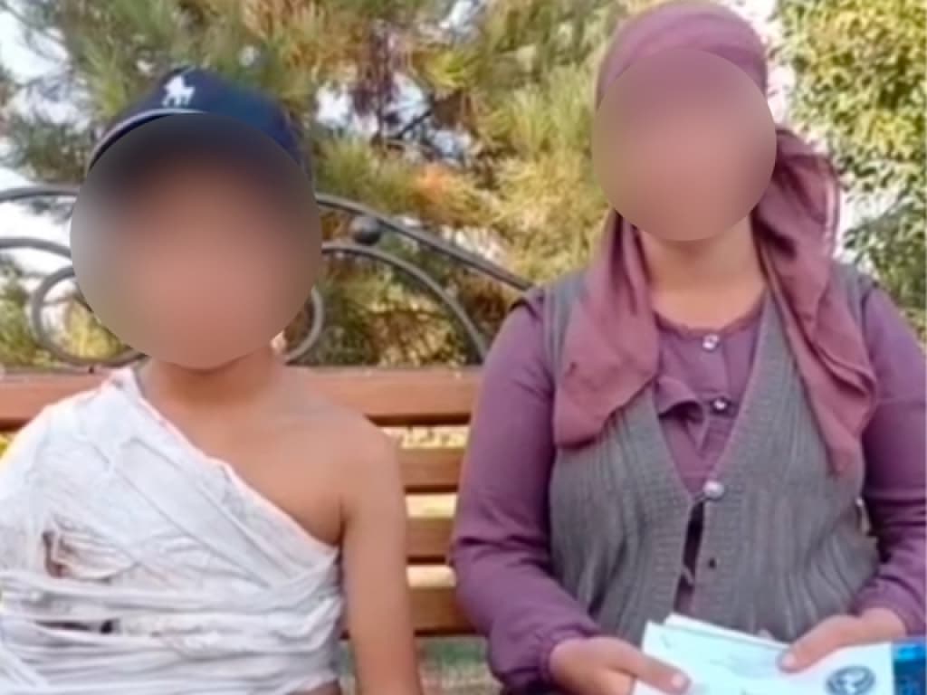 Boysunda o‘qituvchi o‘quvchining yelkasini sindirgani aytilmoqda