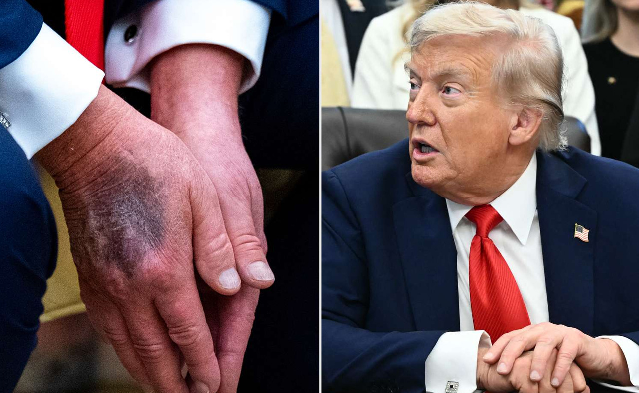 Trump hands